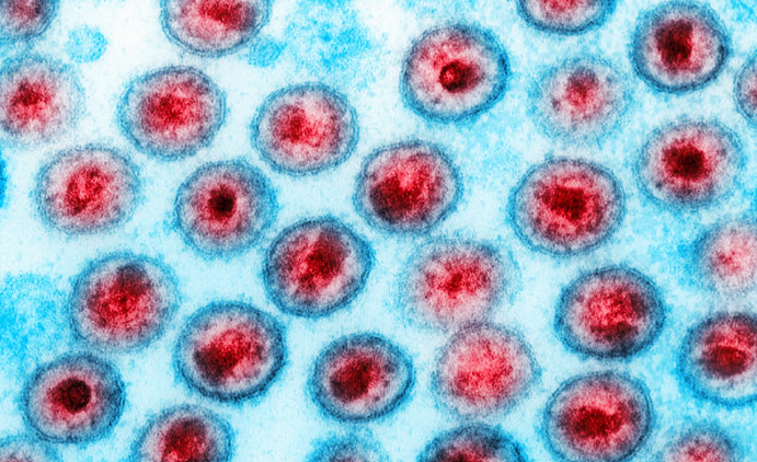 Scientists Discover New HIV Strain In 20 Years